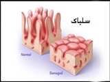 دستورالعملهای بالینی وزارت 1402- پروتکل تشخیصی درمانی بیماری سلیاک